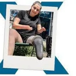 Luxmed - Get Above Knee Prosthetic Leg in ukraine